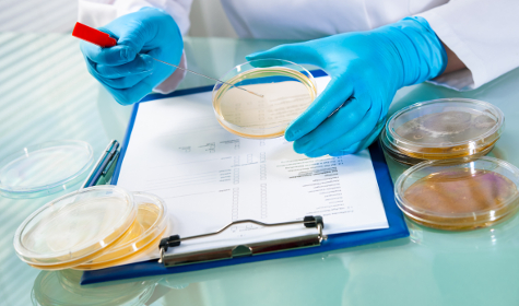 Foto: Mehrere Petrischalen sind zu sehen