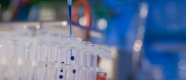 Test im Labor - Vergleichende Bewertung der Eignung von SARS-CoV-2-Antigen- und -Antikörpertests (COVID 19-IVD)