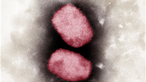 Elektronen-mikroskopische Aufnahme von Affenpocken-Viren, koloriert
