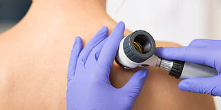 Arzt untersucht Hautflecken eines Patienten mit einem Dermatoskop