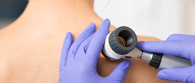 Arzt untersucht Hautflecken eines Patienten mit einem Dermatoskop
