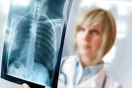 Foto: Eine Ärztin betrachtet das Röntgenbild eines Brustkorbs