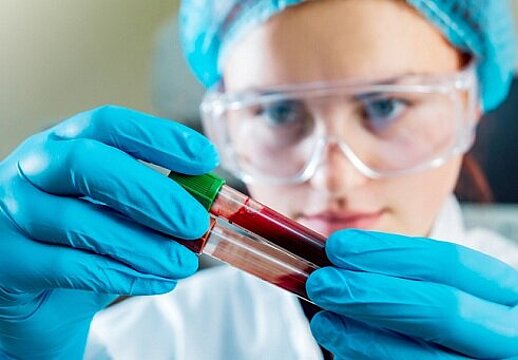 Foto: Ärztin oder Forscherin im Schutzkleidung und mit Brille hält zwei Blutkonserven in den Händen.