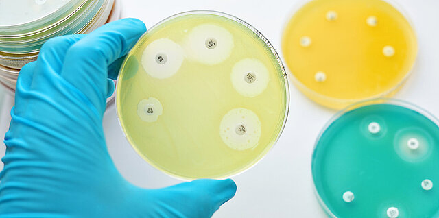 Bakterien besitzen die Fähigkeit gegenüber Antibiotika Resistenzen auszubilden. Ihre Ausbreitung kann mittels geeigneter Werkzeuge überwacht werden.