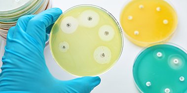Bakterien besitzen die Fähigkeit gegenüber Antibiotika Resistenzen auszubilden. Ihre Ausbreitung kann mittels geeigneter Werkzeuge überwacht werden.